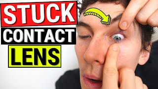 How to Remove a STUCK Contact Lens from the Eye [upl. by Eicyac979]