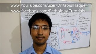 Embolism  Definition Types Pathogenesis Clinical Consequences HD [upl. by Fugate]