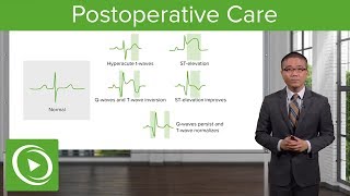 Postoperative Care – Surgery  Lecturio [upl. by Norrej]