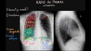 Radio du thorax  Introduction  Partie 1  Docteur Synapse [upl. by Hugh637]