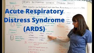 Acute Respiratory Distress Syndrome ARDS [upl. by Enelegna]