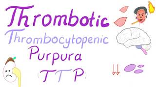 Thrombotic Thrombocytopenic Purpura TTP [upl. by Noswal272]