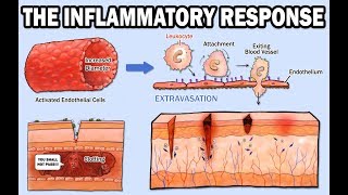 THE INFLAMMATORY RESPONSE [upl. by Gisser]