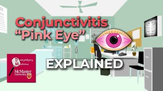 Conjunctivitis Pink Eye Explained [upl. by Weeks]