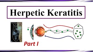 Herpetic Keratitis  Pathogenesis and Clinical Presentation Part I [upl. by Nomma]