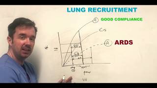 Acute respiratory distress syndrome ARDS [upl. by Eirol827]