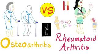 What is psoriatic arthritis [upl. by Schuyler]