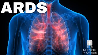 Acute Respiratory Distress Syndrome ARDS [upl. by Ednalrim]