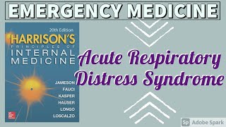 Acute Respiratory Distress Syndrome  Causes  Pathogenesis  Treatment  Harrison [upl. by Notlem822]