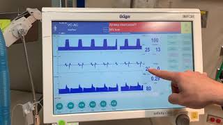 Module 3 Respiratory System and mechanical ventilation  Part 1 [upl. by Paff]