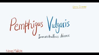 Pemphigus Vulgaris  clinical features pathophysiology and histology  immunobullous skin disease [upl. by Yenruoc688]