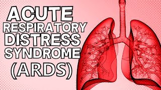 Acute Respiratory Distress Syndrome ARDS [upl. by Short]