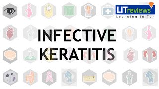 Infective Keratitis [upl. by Maher699]