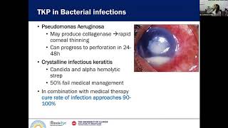 Penetrating Keratoplasty in Infectious Keratitis [upl. by Rigby]