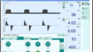 Ventilator settings and modes [upl. by Nessah970]