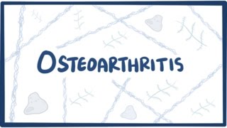 Osteoarthritis vs rheumatoid arthritis symptoms  NCLEXRN  Khan Academy [upl. by Dyrraj]