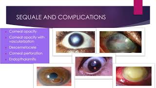 CORNEAL ULCERS [upl. by Elyrrad]