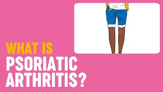 Osteoarthritis vs rheumatoid arthritis pathophysiology  NCLEXRN  Khan Academy [upl. by Nonregla]